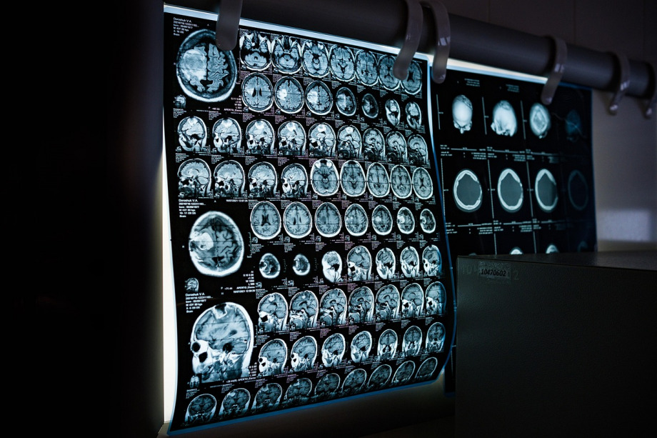 neurology monitoring hospital